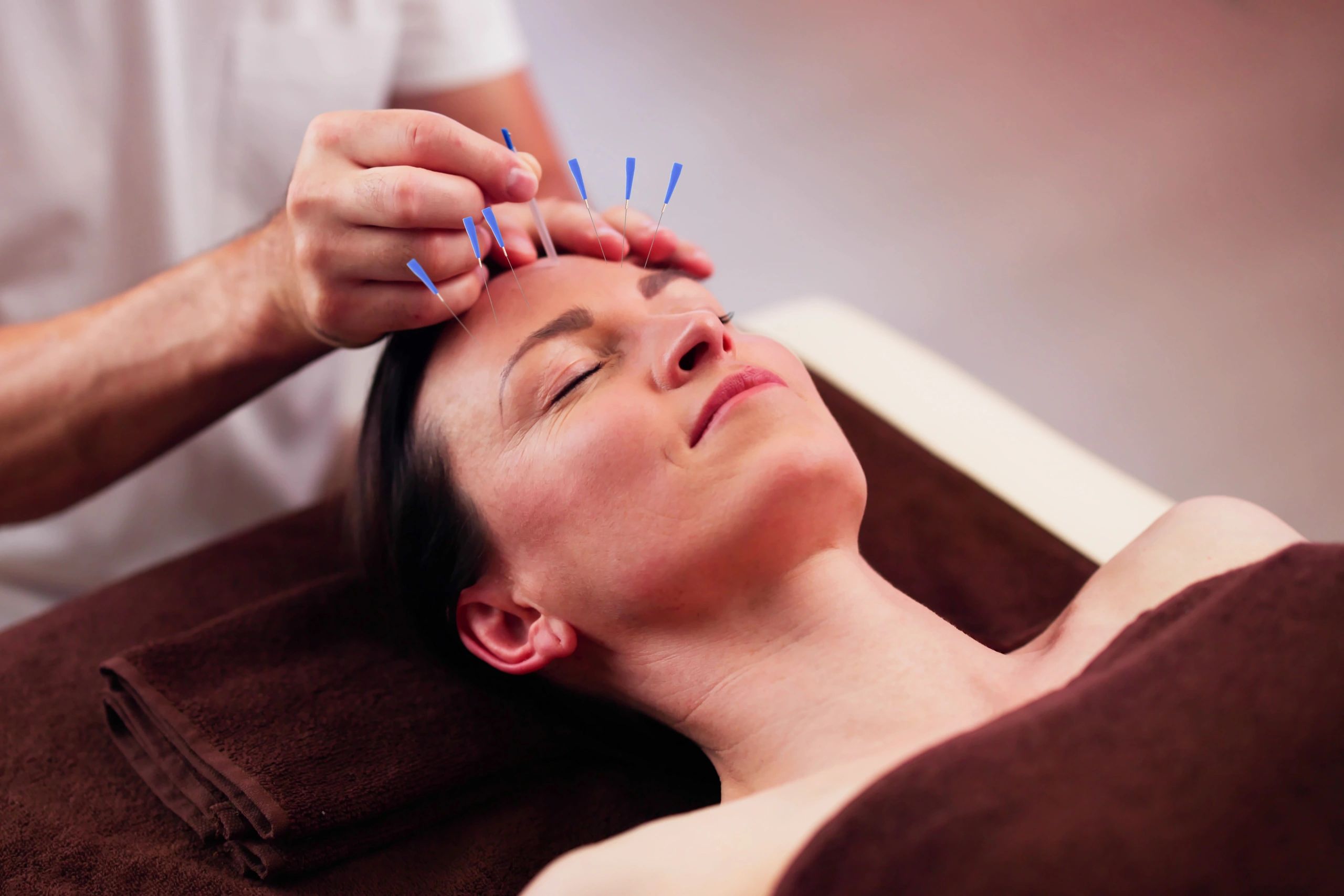 Practitioner providing acupuncture treatment in a calm setting